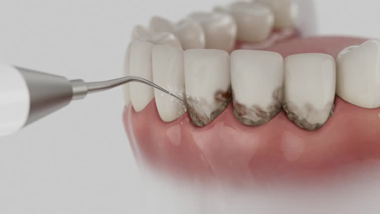 Reliable Emergency Dentist contractor in Windsor, CA by Smile Center Dentistry